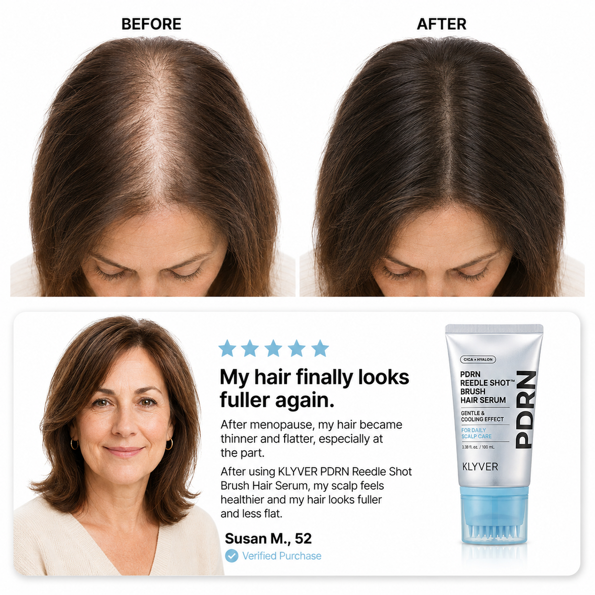 Korean Scalp Serum | Part-line brush, PDRN & fuller-looking roots