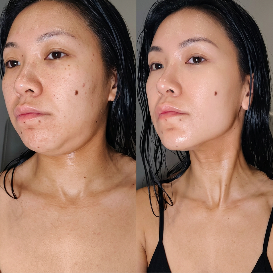 Sereva Before After Results